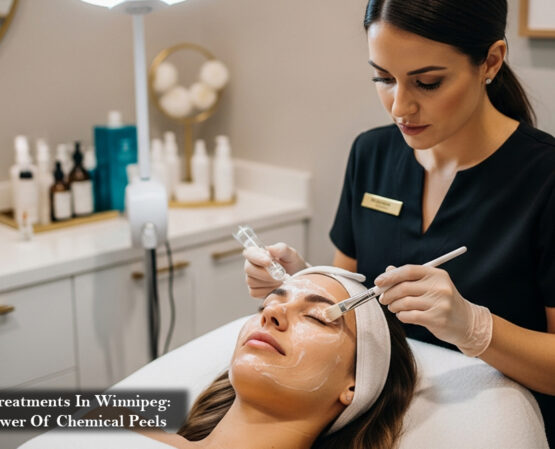 Facial Treatments In Winnipeg The Power Of Chemical Peels